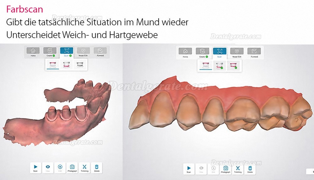 Fussen Dental 3D Digitaler Intraoralscanner